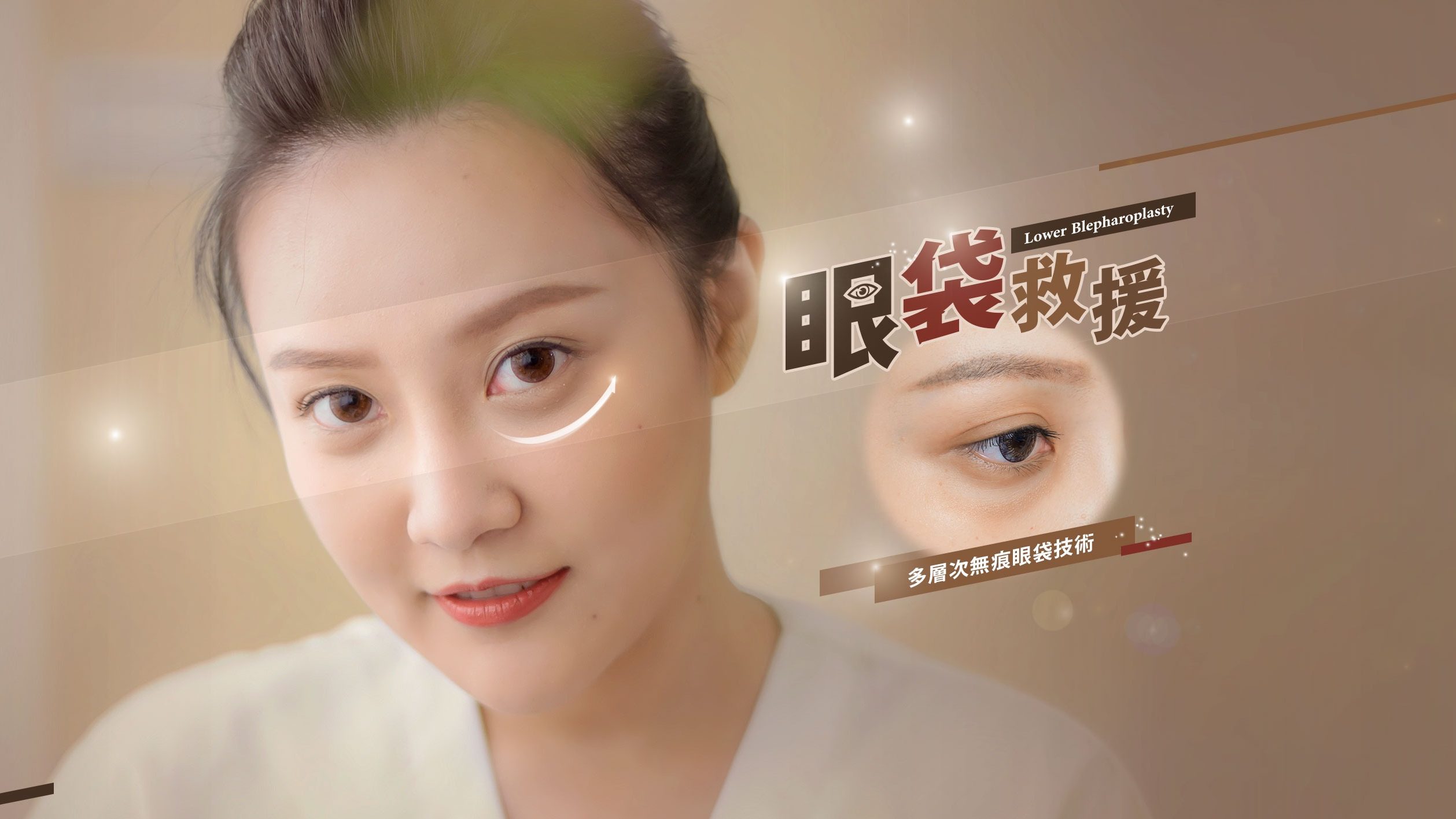 【除眼袋】眼袋為何產生？如何選擇眼袋手術，透過眼袋抽脂讓眼袋不在！