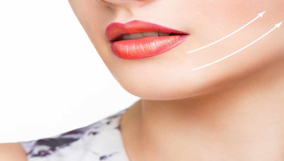 【埋線拉提恢復期】埋線拉提的恢復期？多久可以化妝？