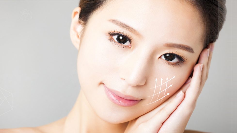 【埋線法令紋】法令紋打玻尿酸好，還是埋線有用？