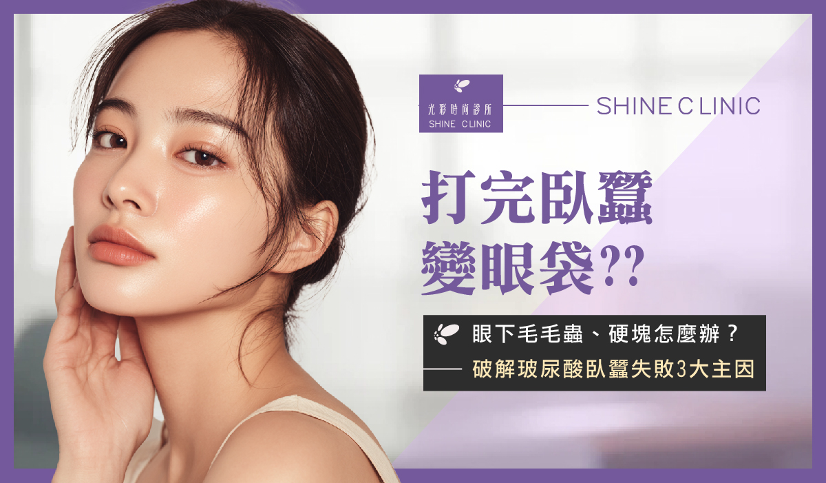 打完臥蠶變眼袋?眼下毛毛蟲、硬塊怎麼辦?破解玻尿酸臥蠶失敗 3 大主因!