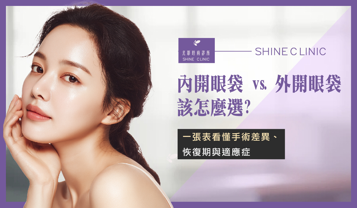 內開眼袋 vs. 外開眼袋該怎麼選？一張表看懂手術差異、恢復期與適應症